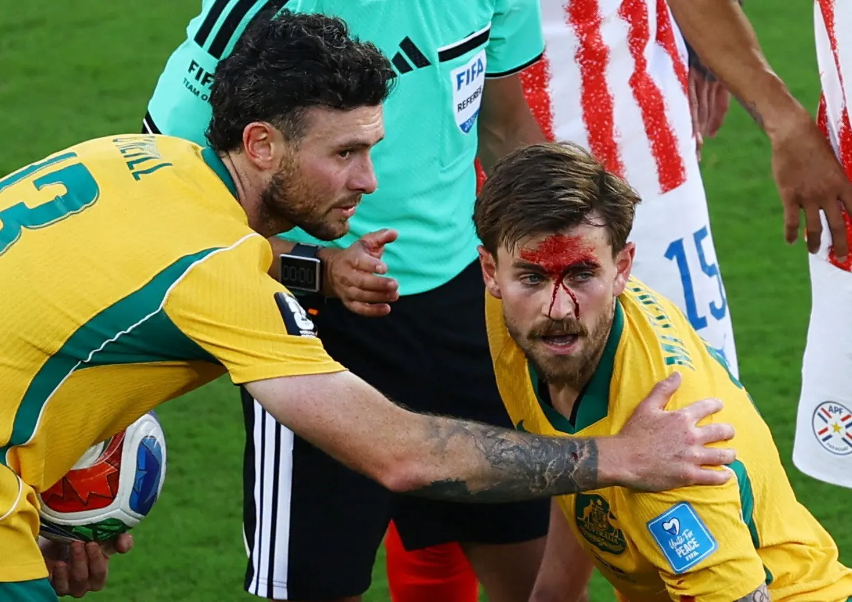 Jogador da Austrália, Connor Metcalfe, com curativo no rosto após sofrer corte durante partida da Copa do Mundo contra o Paraguai.